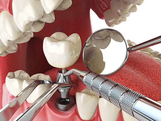 Best Broken or Cracked Tooth Emergency Dentist in Anchor Point, AK